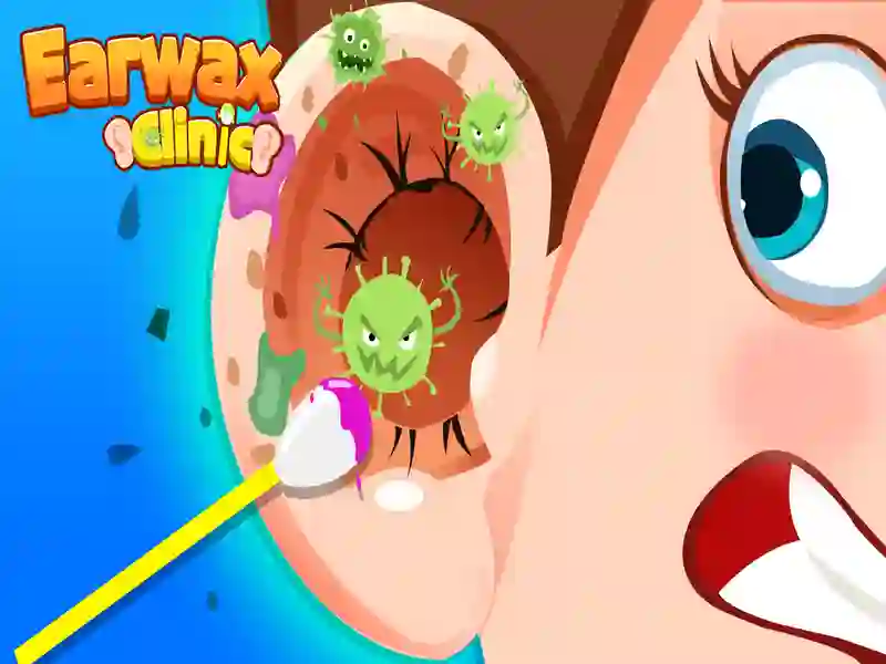 שפּיל Earwax קינילק אָנליין